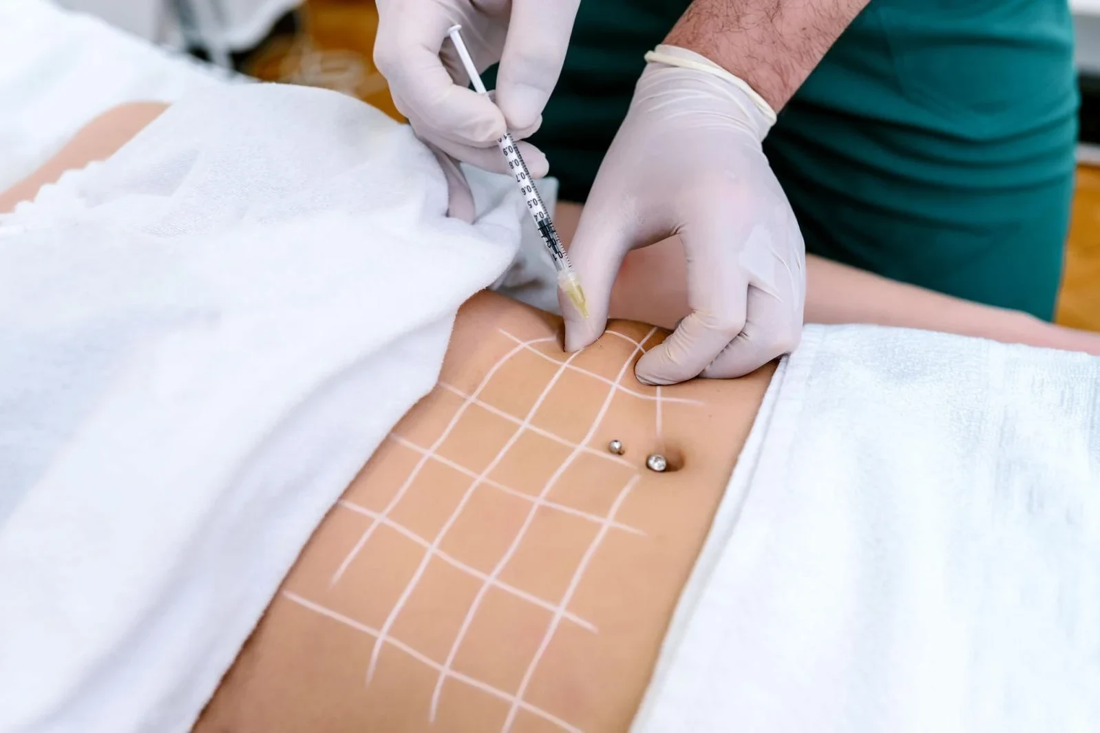 Curious about the safety of weight loss injections? Woman's having lipolysis treatment